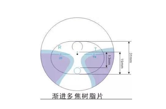 美麗島多焦鏡適合的人群，需要注意的事項